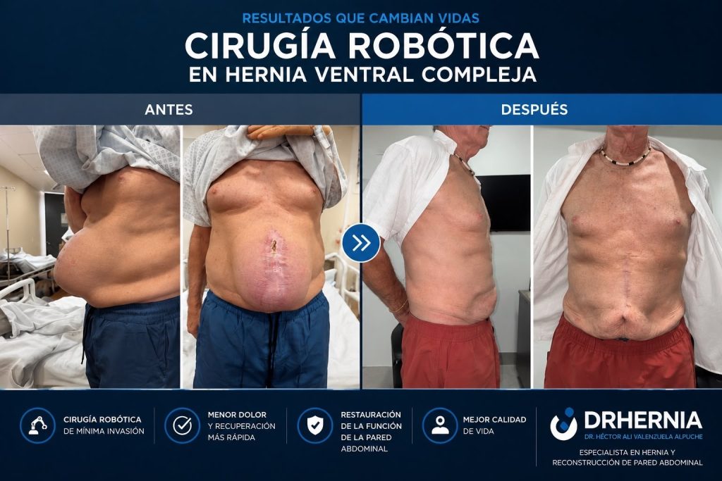 antes y después de operar una hernia